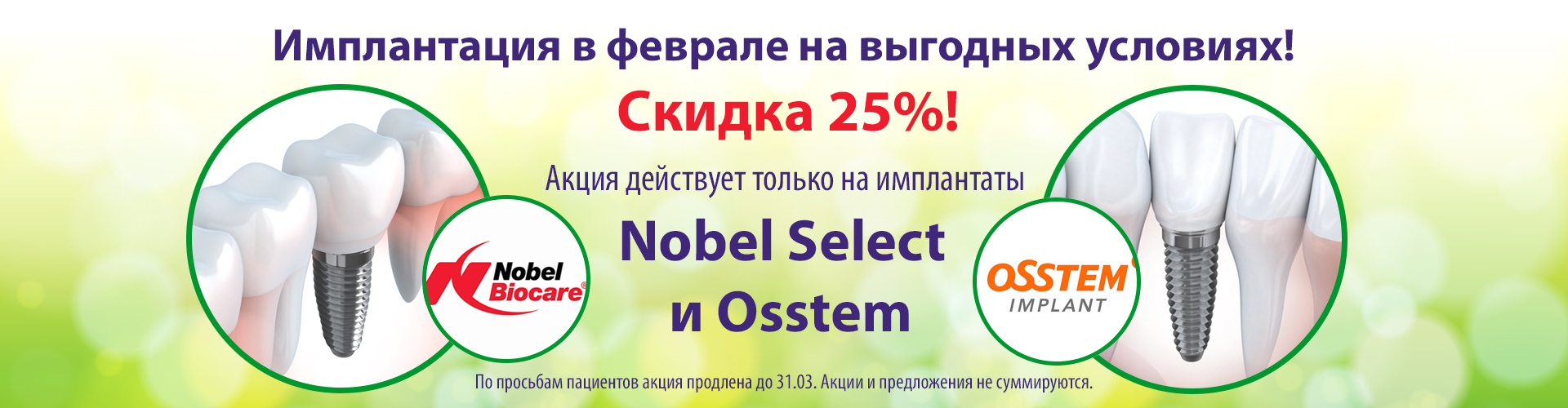 Имплантация в феврале на выгодных условиях