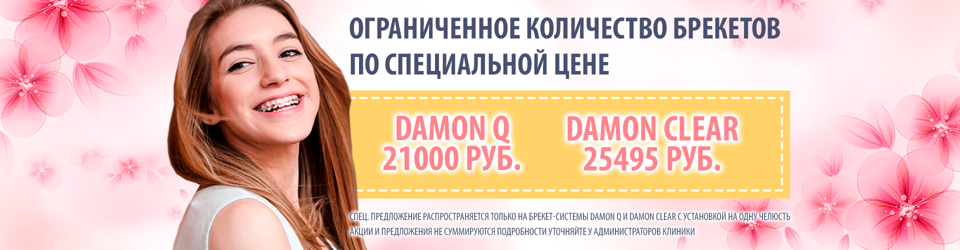 Ограниченное количество брекетов по специальной цене